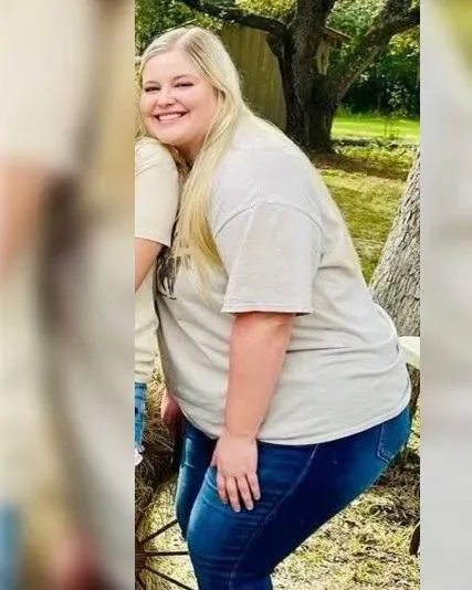 Before weight loss surgery