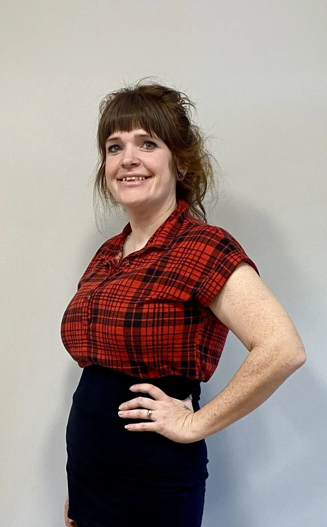 After weight loss surgery