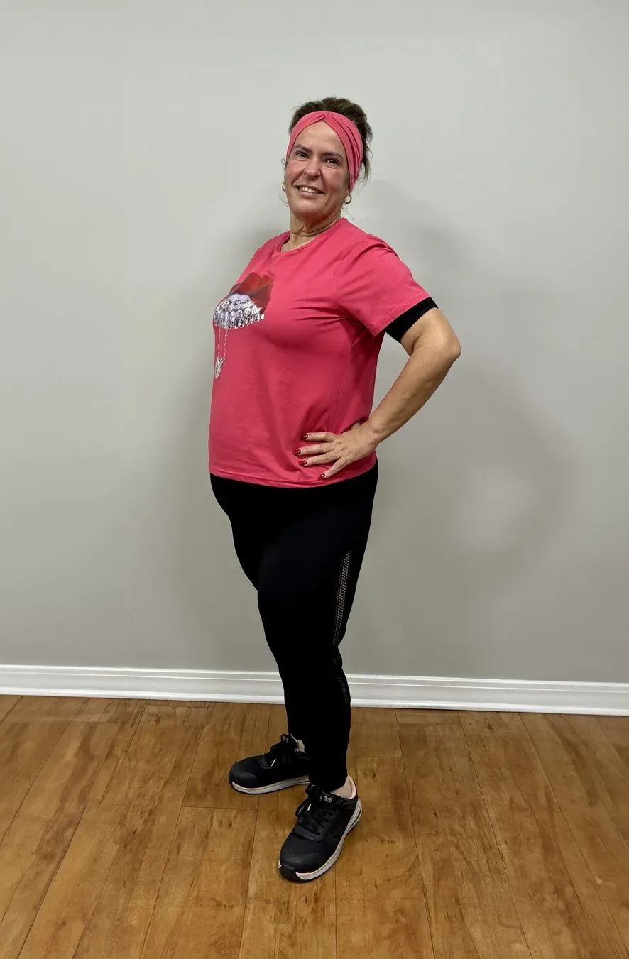 After weight loss surgery