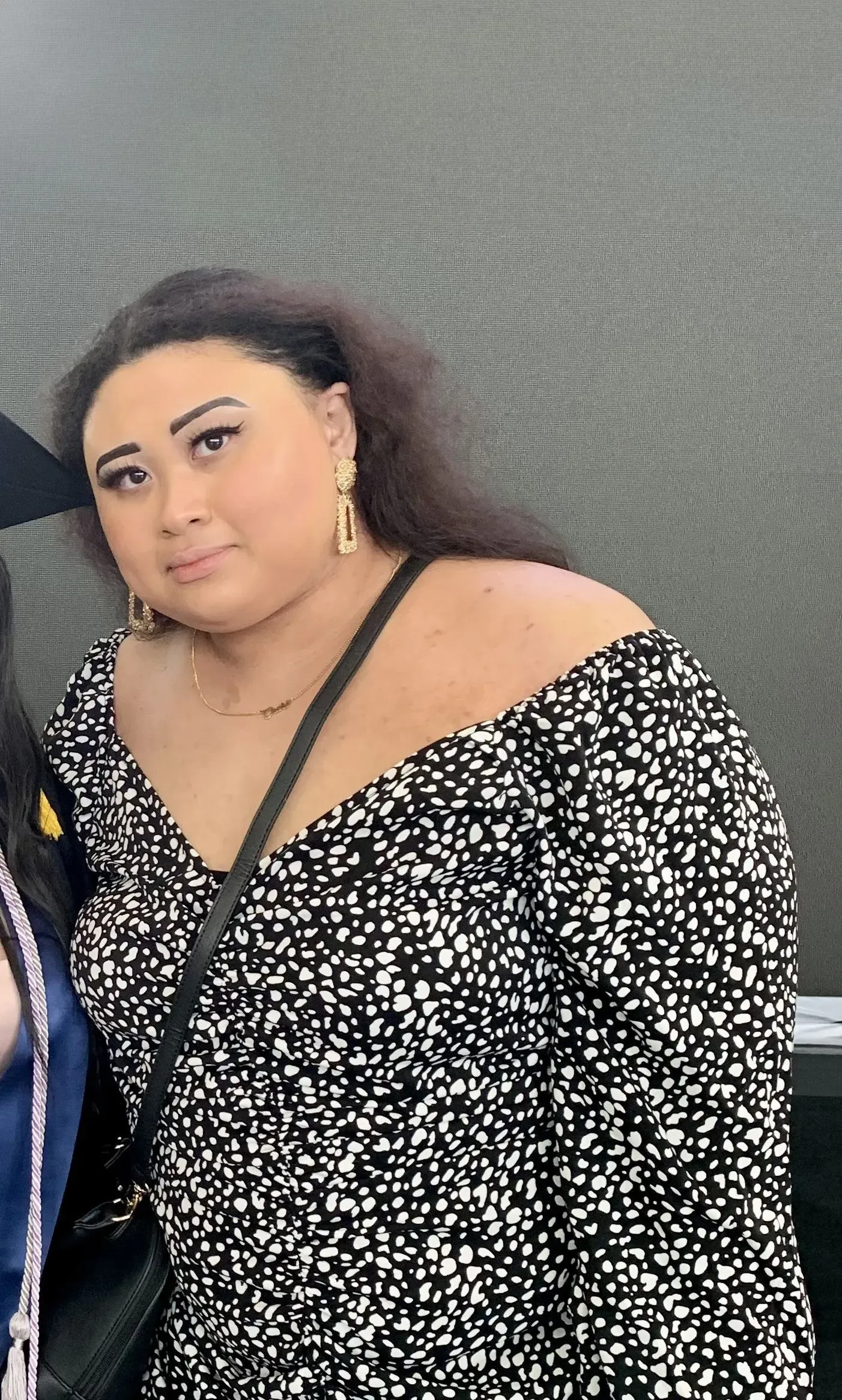 Before weight loss surgery