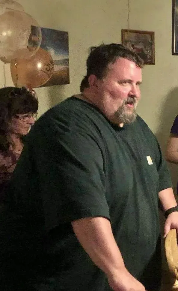 Before weight loss surgery