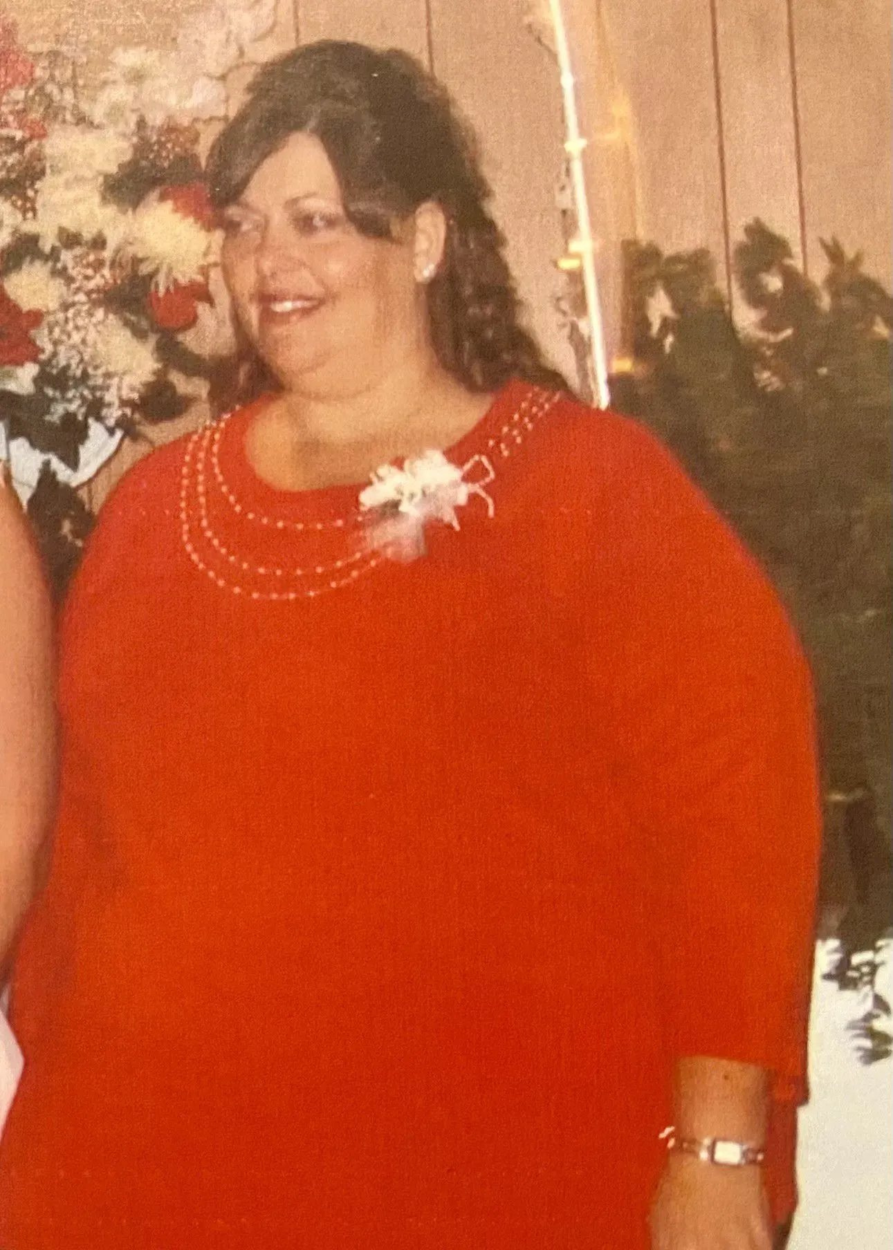 Before weight loss surgery