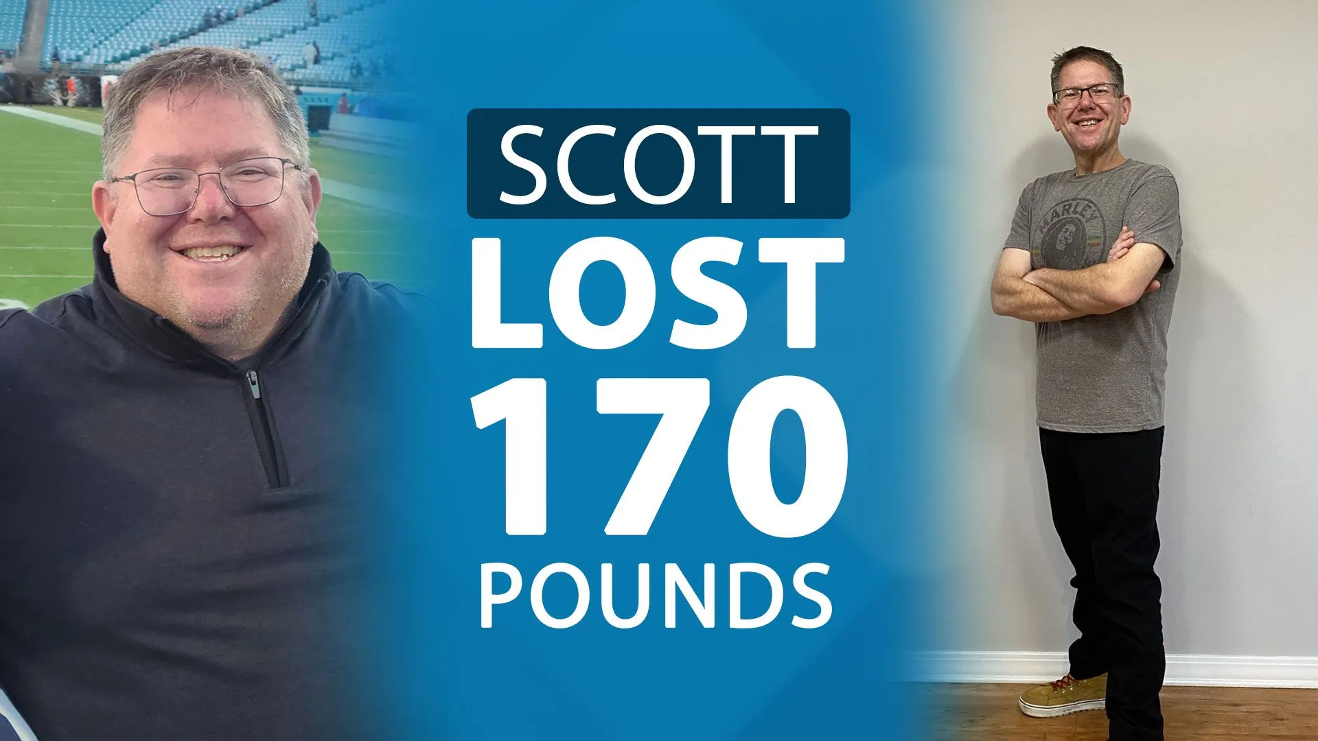 VIDEO: 170-Pound Weight Loss with Bariatric Surgery & Dr. Baptista's Guidance